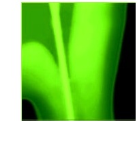Endo4.jpg