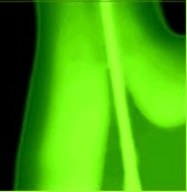 Endo3.jpg